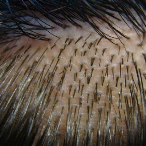  After confirming identifying information, the collector will cut between and hairs from the crown of your head